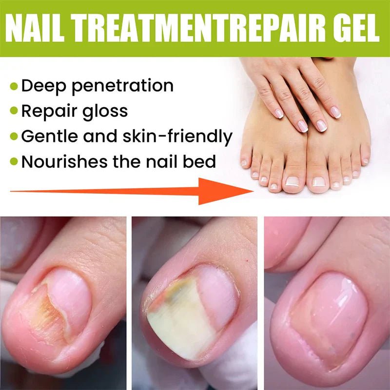 EELHOE – Nail Treatment Repair Gel - Mifha's Beauty