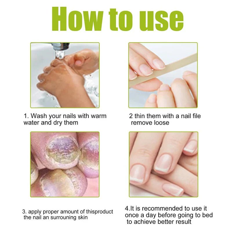EELHOE – Nail Treatment Repair Gel - Mifha's Beauty